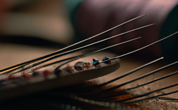 Needles and Nodes: Acupuncture’s Ancient Chronicles