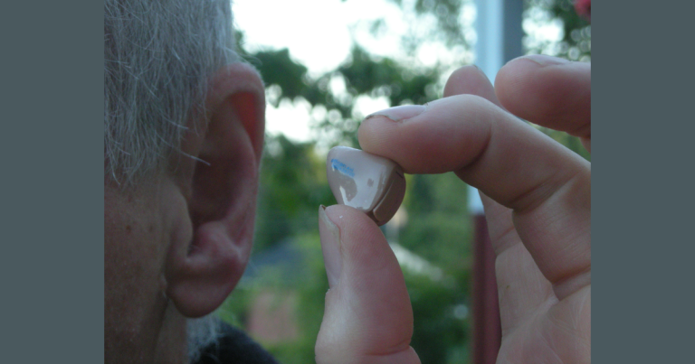 A hand holds a small hearing aid beside an ear in a historical close-up photograph